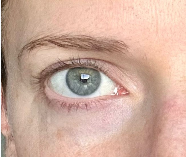Customer photo of lashes before starting Root 1